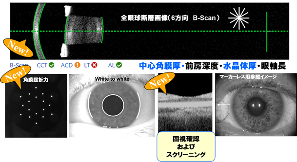 IOLマスター700の測定イメージ写真