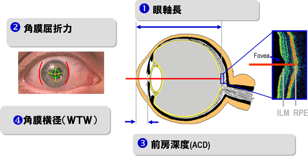 眼内レンズ度数計算に必要な測定項目のイメージ図