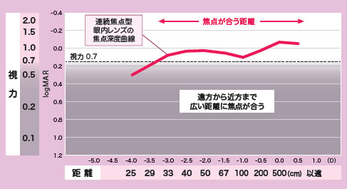 連続焦点型眼内レンズで焦点が合う距離の図