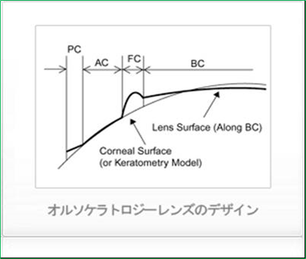 lens design