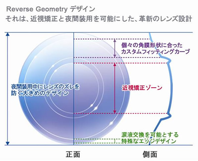 オルソケラトロジーの構造