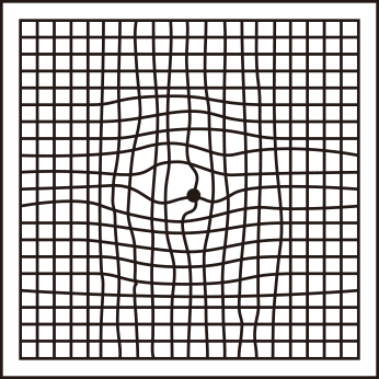 アムスラーチャートの中心が歪んで見えたイメージ
